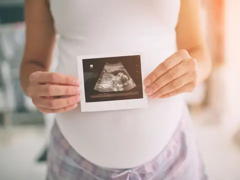 Schwangere Frau hält Ultraschallbild in die Kamera