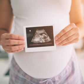 Schwangere Frau hält Ultraschallbild in die Kamera