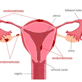 Infografik