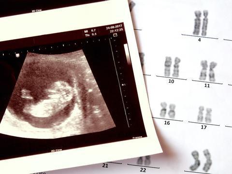 Ultraschallbild - Schwangerschaft